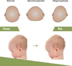 Novalits - Orthopedisch Baby Zijslaapkussen Met Traagschuim En Anti-Allergene Bamboe Microvezel Stof Om Een Plat Hoofd Tegen Te Gaan - Zijligkussen Voor Peuter - Babykussen Zijligging - Rolkussen - Steunkussen - Slaapondersteuning 16 Novalits - Orthopedisch Baby Zijslaapkussen Met Traagschuim En Anti-Allergene Bamboe Microvezel Stof Om Een Plat Hoofd Tegen Te Gaan - Zijligkussen Voor Peuter - Babykussen Zijligging - Rolkussen - Steunkussen - Slaapondersteuning -Babyproducten 1200x1103 3