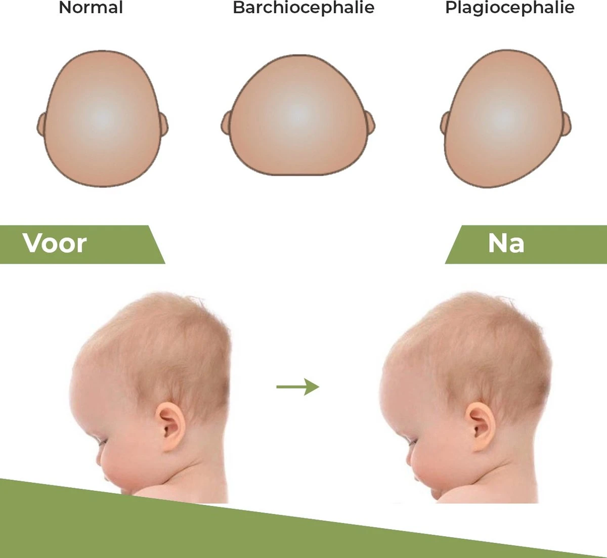 Novalits - Orthopedisch Baby Zijslaapkussen Met Traagschuim En Anti-Allergene Bamboe Microvezel Stof Om Een Plat Hoofd Tegen Te Gaan - Zijligkussen Voor Peuter - Babykussen Zijligging - Rolkussen - Steunkussen - Slaapondersteuning 8 Novalits - Orthopedisch Baby Zijslaapkussen Met Traagschuim En Anti-Allergene Bamboe Microvezel Stof Om Een Plat Hoofd Tegen Te Gaan - Zijligkussen Voor Peuter - Babykussen Zijligging - Rolkussen - Steunkussen - Slaapondersteuning - Afbeelding 6